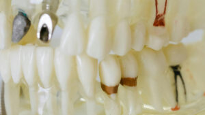 Teeth Model