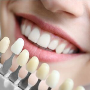 Cosmetic Dentistry 2 teeth whitening