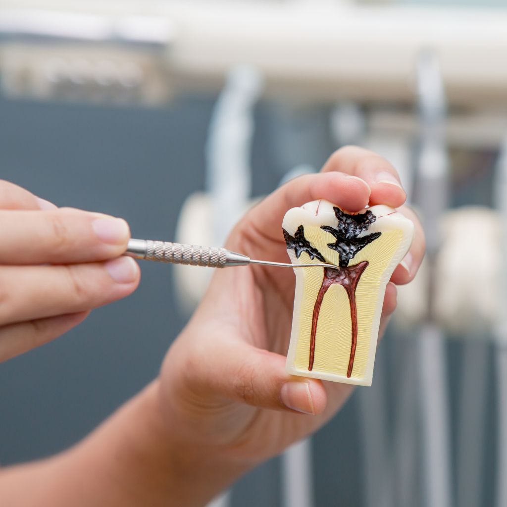 endodontist showing a root canal